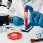 أنبوب عينة دم أحمر بغطاء أحمر داخل مختبر وتمسكه قفاز زرقاء، ضمن فحوصات التحاليل المخبرية ودلالاتها لفهم نتائجك الصحية بدقة.